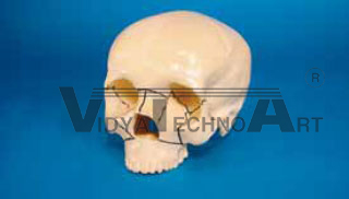 Skull, with holder, fractured